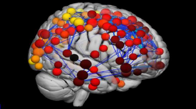 Scans reveal how teenage brain develops